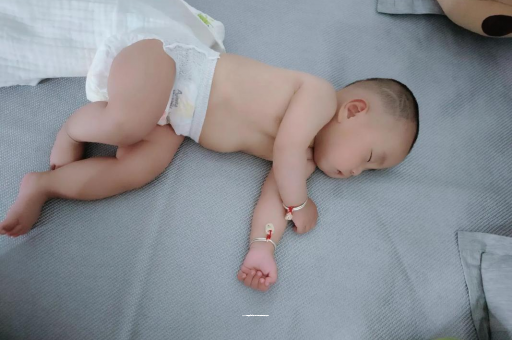 中国澳门宝宝头上长痱子